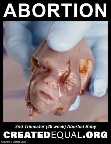 Abortion Victim Sign