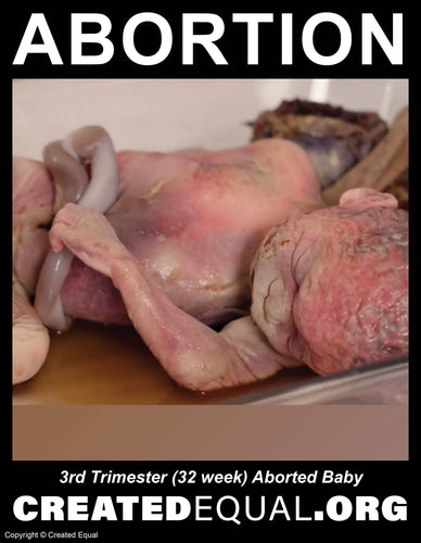 Abortion Victim Sign