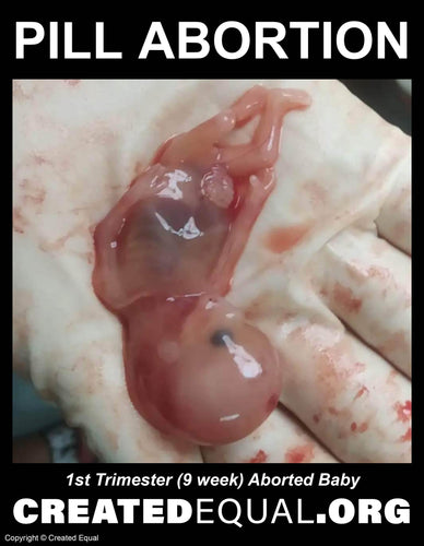 Pill Abortion Victim Sign