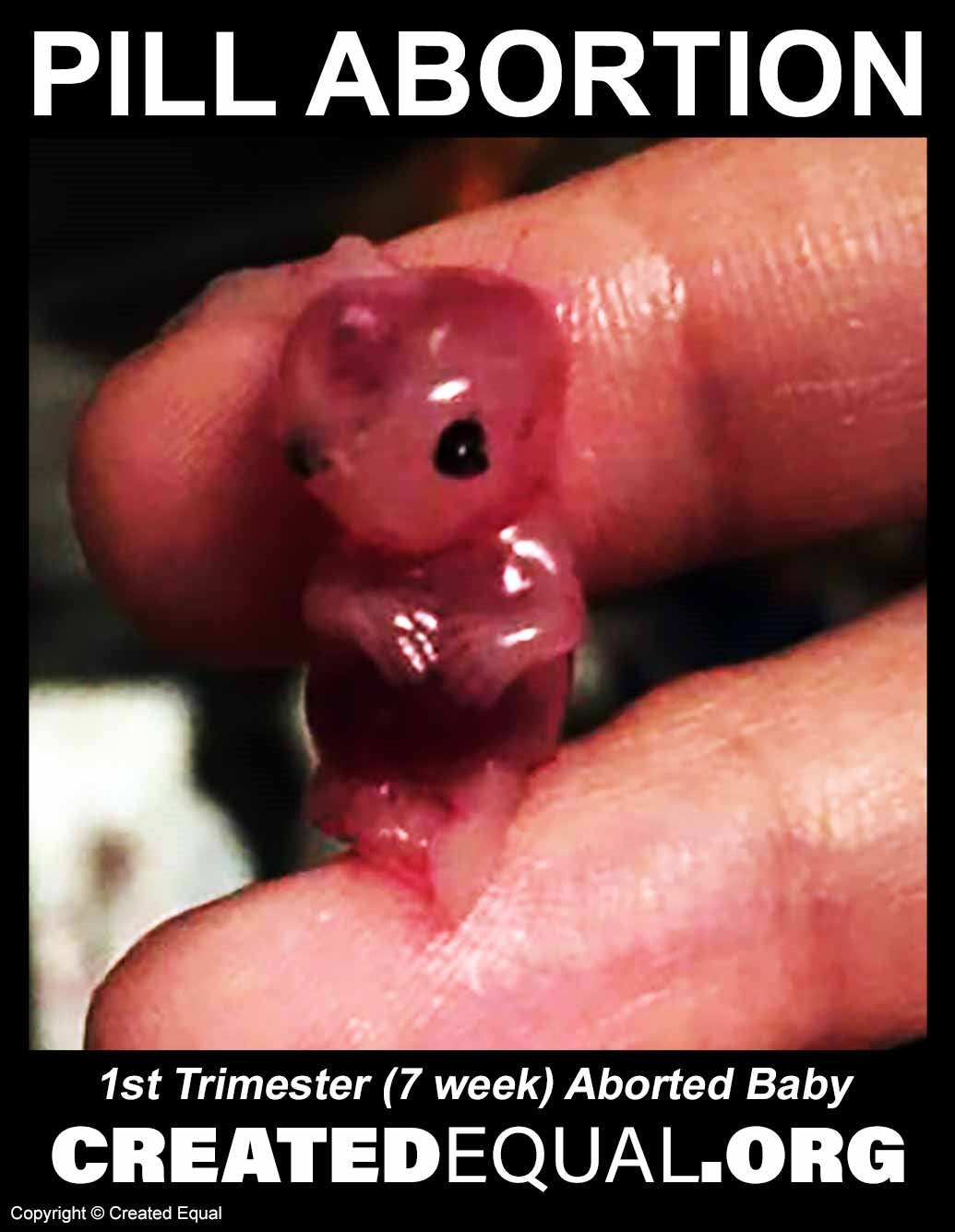 Pill Abortion Victim Sign