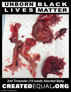 Abortion Victim/Unborn Black Lives Matter Sign
