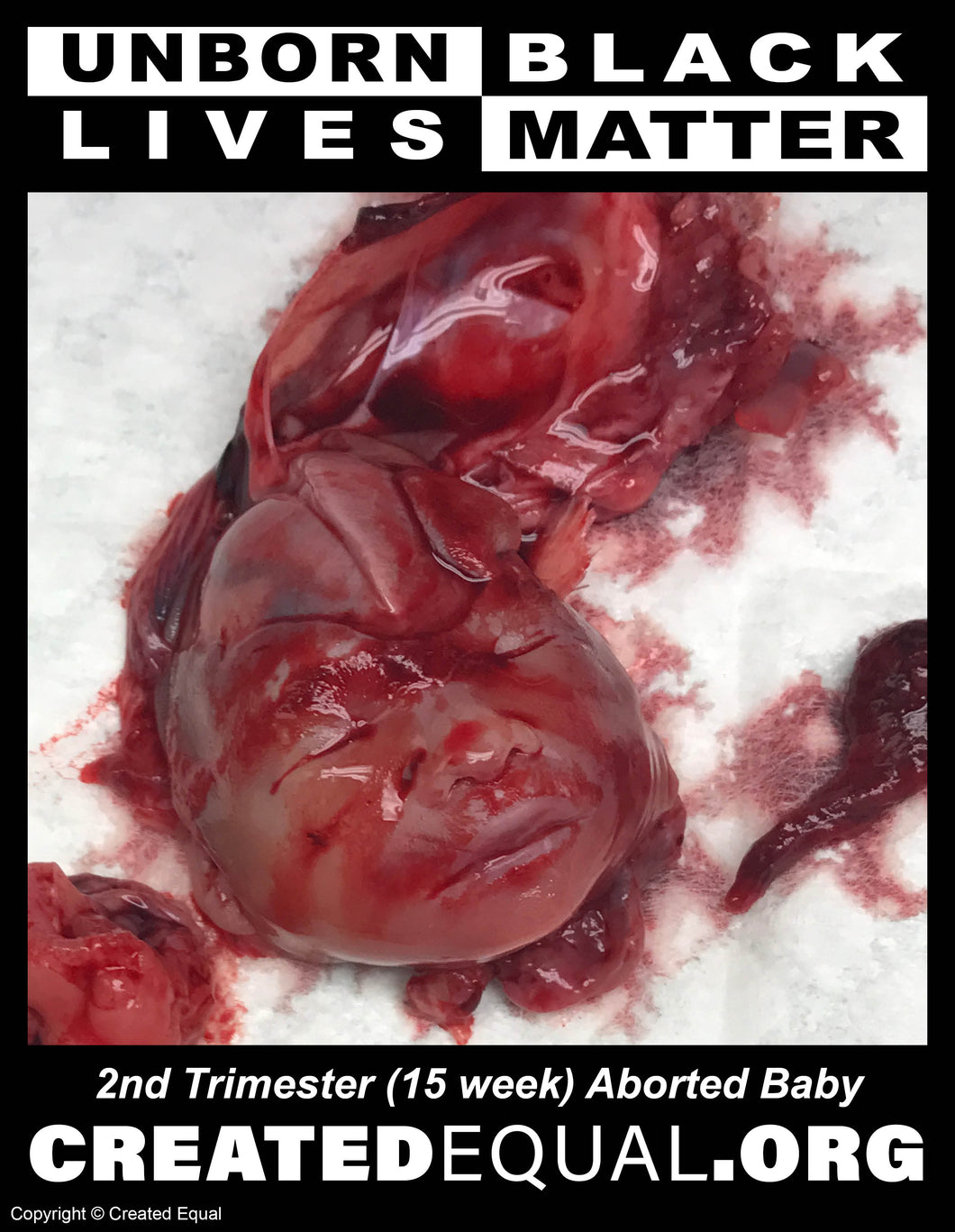 Abortion Victim/Unborn Black Lives Matter Sign