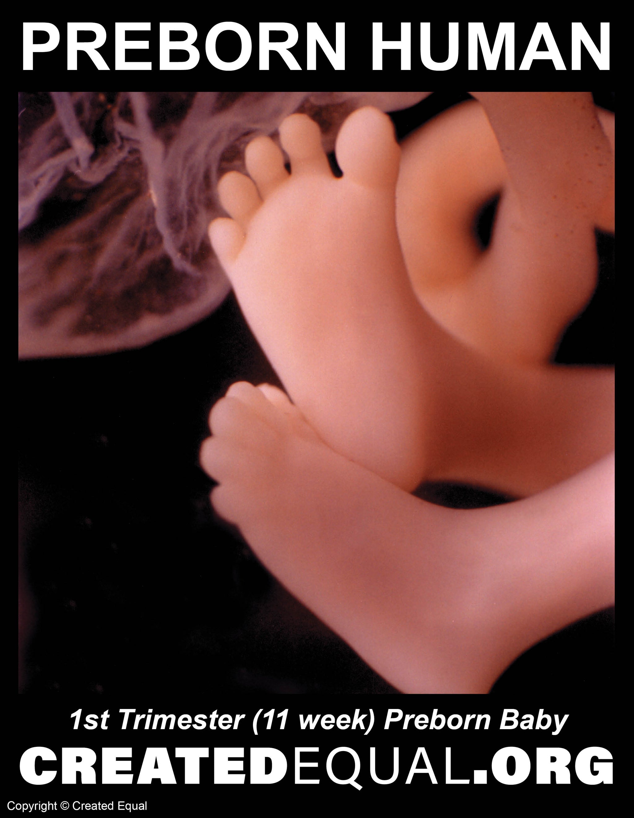 Preborn Baby Signs – Created Equal Store