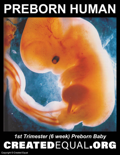 Preborn Baby Sign